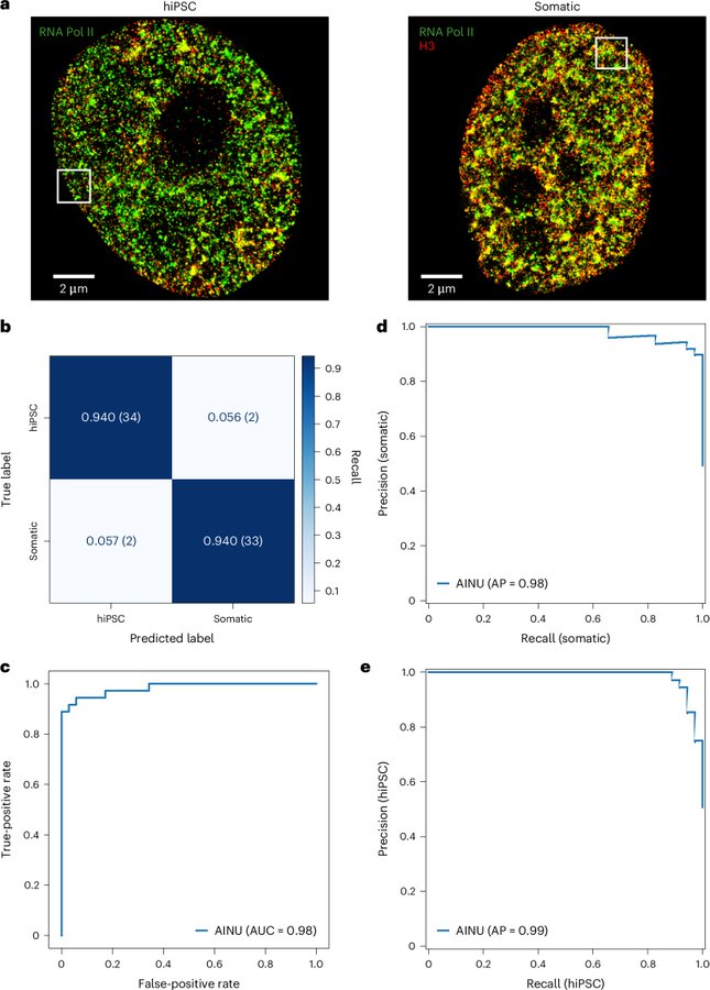 Researchers develop AINU (AI) to detect cancer and viral infections with nanoscale precision